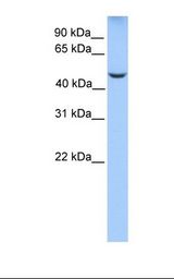 JADE1 / PHF17 Antibody - Fetal brain lysate. Antibody concentration: 1.0 ug/ml. Gel concentration: 12%.  This image was taken for the unconjugated form of this product. Other forms have not been tested.