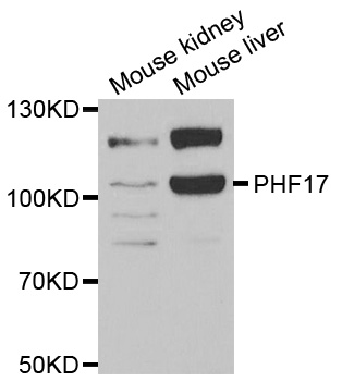 JADE1 / PHF17 Antibody - Western blot analysis of extracts of various cell lines.