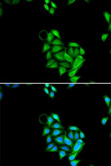 JADE1 / PHF17 Antibody - Immunofluorescence analysis of U2OS cells.