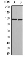 JADE1 / PHF17 Antibody - Western blot analysis of PHF17 expression in mouse kidney (A); mouse liver (B) whole cell lysates.
