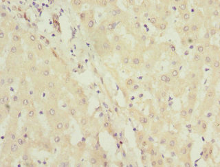 JADE1 / PHF17 Antibody - Immunohistochemistry of paraffin-embedded human liver tissue at dilution 1:100