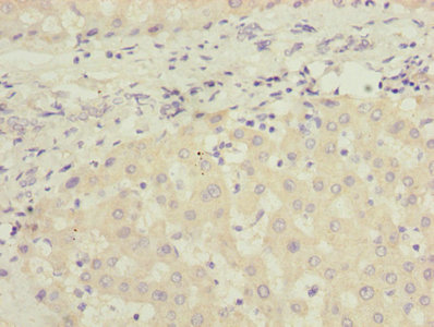 JADE1 / PHF17 Antibody - Immunohistochemistry of paraffin-embedded human liver tissue using JADE1 Antibody at dilution of 1:100