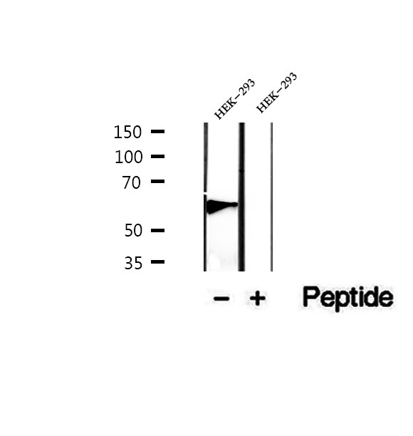 JADE1 / PHF17 Antibody - Western blot analysis of extracts of HEK293 cells using PHF17 antibody.
