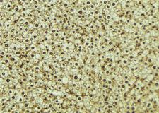 JADE1 / PHF17 Antibody - 1:100 staining mouse liver tissue by IHC-P. The sample was formaldehyde fixed and a heat mediated antigen retrieval step in citrate buffer was performed. The sample was then blocked and incubated with the antibody for 1.5 hours at 22°C. An HRP conjugated goat anti-rabbit antibody was used as the secondary.