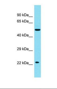 JADE2 / PHF15 Antibody - Western blot of Human Liver Tumor. PHF15 antibody dilution 1.0 ug/ml.  This image was taken for the unconjugated form of this product. Other forms have not been tested.