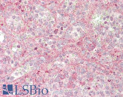 JAG1 / Jagged 1 Antibody - Human Spleen: Formalin-Fixed, Paraffin-Embedded (FFPE)