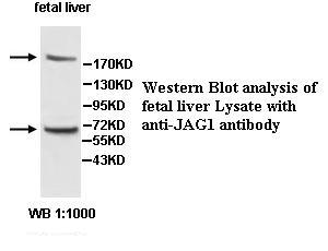 JAG1 / Jagged 1 Antibody