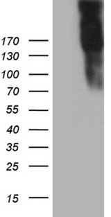 JAG1 / Jagged 1 Antibody - HEK293T cells were transfected with the pCMV6-ENTRY control. (Left lane) or pCMV6-ENTRY JAG1. (Right lane) cDNA for 48 hrs and lysed. Equivalent amounts of cell lysates. (5 ug per lane) were separated by SDS-PAGE and immunoblotted with anti-JAG1. (1:2000)