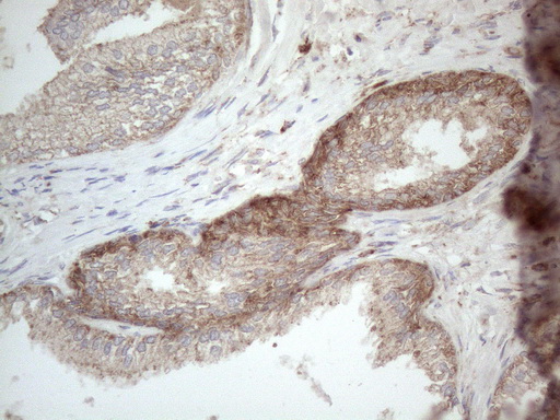 JAG1 / Jagged 1 Antibody - Immunohistochemical staining of paraffin-embedded Human prostate tissue within the normal limits using anti-JAG1 mouse monoclonal antibody. (Heat-induced epitope retrieval by 1mM EDTA in 10mM Tris buffer. (pH8.5) at 120°C for 3 min. (1:150)