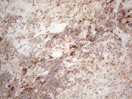 JAG1 / Jagged 1 Antibody - Immunohistochemical staining of paraffin-embedded Human lymph node tissue within the normal limits using anti-JAG1 mouse monoclonal antibody. (Heat-induced epitope retrieval by 1mM EDTA in 10mM Tris buffer. (pH8.5) at 120°C for 3 min. (1:150)