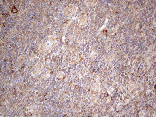 JAG1 / Jagged 1 Antibody - Immunohistochemical staining of paraffin-embedded Human tonsil within the normal limits using anti-JAG1 mouse monoclonal antibody. (Heat-induced epitope retrieval by 1mM EDTA in 10mM Tris buffer. (pH8.5) at 120°C for 3 min. (1:150)