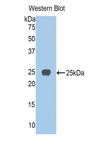 JAG1 / Jagged 1 Antibody - Western blot of recombinant JAG1 / Jagged 1.  This image was taken for the unconjugated form of this product. Other forms have not been tested.