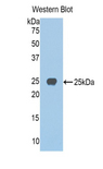 JAG1 / Jagged 1 Antibody - Western blot of recombinant JAG1 / Jagged 1.  This image was taken for the unconjugated form of this product. Other forms have not been tested.