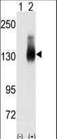 JAG2 / Jagged-2 Antibody - Western blot of Jag2 (arrow) using JAG2 Antibody. 293 cell lysates (2 ug/lane) either nontransfected (Lane 1) or transiently transfected with the JAG2 gene (Lane 2) (Origene Technologies).