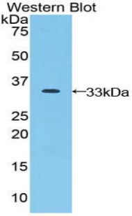 JAG2 / Jagged-2 Antibody - Western blot of recombinant JAG2 / Jagged-2.  This image was taken for the unconjugated form of this product. Other forms have not been tested.