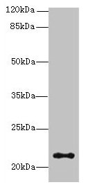 JAGN1 Antibody - Western blot All lanes: JAGN1 antibody at 3µg/ml + HL60 whole cell lysate Secondary Goat polyclonal to rabbit IgG at 1/10000 dilution Predicted band size: 21 kDa Observed band size: 21 kDa