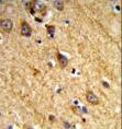 JAKMIP1 Antibody - Formalin-fixed and paraffin-embedded human brain tissue reacted with JAKMIP1 Antibody , which was peroxidase-conjugated to the secondary antibody, followed by DAB staining. This data demonstrates the use of this antibody for immunohistochemistry; clinical relevance has not been evaluated.