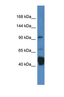 JAKMIP2 Antibody - JAKMIP2 antibody Western blot of Fetal Lung lysate. Antibody concentration 1 ug/ml.  This image was taken for the unconjugated form of this product. Other forms have not been tested.