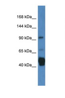 JAKMIP2 Antibody - JAKMIP2 antibody Western blot of Fetal Lung lysate. Antibody concentration 1 ug/ml.  This image was taken for the unconjugated form of this product. Other forms have not been tested.