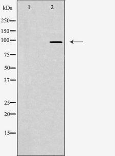 JAKMIP2 Antibody - Western blot analysis of extracts of LOVO cells using JKIP2 antibody. The lane on the left is treated with the antigen-specific peptide.