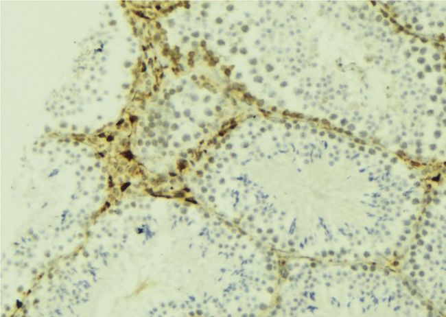 JAKMIP2 Antibody - 1:100 staining mouse testis tissue by IHC-P. The sample was formaldehyde fixed and a heat mediated antigen retrieval step in citrate buffer was performed. The sample was then blocked and incubated with the antibody for 1.5 hours at 22°C. An HRP conjugated goat anti-rabbit antibody was used as the secondary.