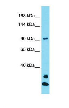 JAKMIP3 Antibody - Western blot of Human Jurkat. JAKMIP3 antibody dilution 1.0 ug/ml.  This image was taken for the unconjugated form of this product. Other forms have not been tested.