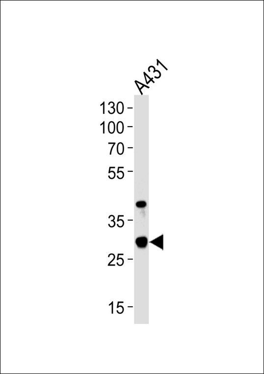 JAM2 Antibody - Western blot of lysate from A431 cell line, using JAM2 Antibody. Antibody was diluted at 1:1000 at each lane. A goat anti-rabbit IgG H&L (HRP) at 1:5000 dilution was used as the secondary antibody. Lysate at 35ug per lane.