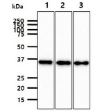 JAM2 Antibody - The cell lysates (40ug) were resolved by SDS-PAGE, transferred to PVDF membrane and probed with anti-human JAM2 antibody (1:1000). Proteins were visualized using a goat anti-mouse secondary antibody conjugated to HRP and an ECL detection system. Lane 1.: K562 cell lysate Lane 2.: LNCaP cell lysate Lane 3.: A549 cell lysate