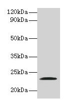 JAM2 Antibody - Western blot All lanes: Junctional adhesion molecule B antibody at 2µg/ml + recombinant Junctional adhesion molecule B protein Secondary Goat polyclonal to rabbit IgG at 1/10000 dilution Predicted band size: 34, 30, 35 kDa Observed band size: 23 kDa