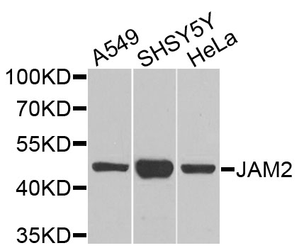 JAM2 Antibody - Western blot analysis of extracts of various cells.
