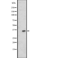 JAM2 Antibody - Western blot analysis of JAM2 expression in HuvEc cells lysate. The lane on the left is treated with the antigen-specific peptide.