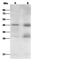 JAM2 Antibody - Anti-JAM2 rabbit polyclonal antibody at 1:500 dilution. Lane A: A431 Whole Cell Lysate. Lane B: Hela Whole Cell Lysate. Lysates/proteins at 30 ug per lane. Secondary: Goat Anti-Rabbit IgG (H+L)/HRP at 1/10000 dilution. Developed using the ECL technique. Performed under reducing conditions. Predicted band size: 33 kDa. Observed band size: 43 kDa. (We are unsure as to the identity of these extra bands.)