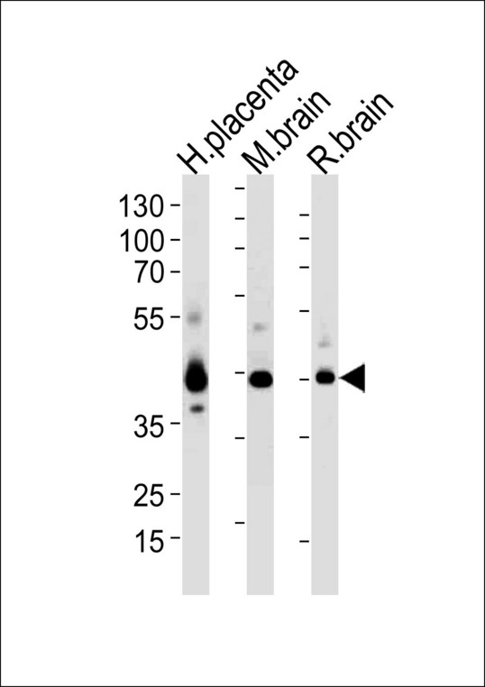 JAM3 Antibody - Western blot of lysates from human placenta, mouse brain and rat brain tissue (from left to right) with JAM3 Antibody. Antibody was diluted at 1:1000 at each lane. A goat anti-rabbit (HRP) at 1:5000 dilution was used as the secondary antibody. Lysates at 35 ug per lane.