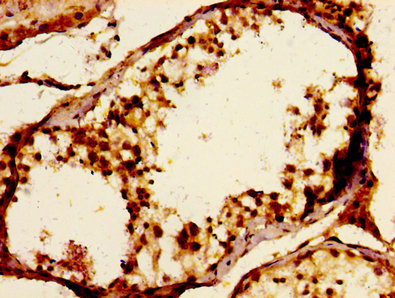 JAM3 Antibody - Immunohistochemistry image of paraffin-embedded human testis tissue at a dilution of 1:100
