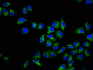 JAM3 Antibody - Immunofluorescence staining of Hela cells with JAM3 Antibody at 1:166, counter-stained with DAPI. The cells were fixed in 4% formaldehyde, permeabilized using 0.2% Triton X-100 and blocked in 10% normal Goat Serum. The cells were then incubated with the antibody overnight at 4°C. The secondary antibody was Alexa Fluor 488-congugated AffiniPure Goat Anti-Rabbit IgG(H+L).