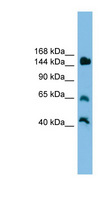 JARID2 / JMJ Antibody - JARID2 antibody Western blot of Mouse Liver lysate. This image was taken for the unconjugated form of this product. Other forms have not been tested.