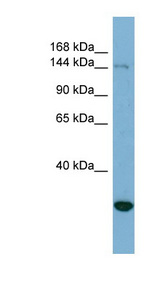 JARID2 / JMJ Antibody - JARID2 antibody Western blot of HeLa lysate. This image was taken for the unconjugated form of this product. Other forms have not been tested.