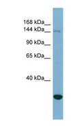 JARID2 / JMJ Antibody - JARID2 antibody Western blot of HeLa lysate. This image was taken for the unconjugated form of this product. Other forms have not been tested.