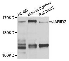 JARID2 / JMJ Antibody - Western blot analysis of extracts of various cells.