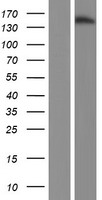 JARID2 / JMJ Protein - Western validation with an anti-DDK antibody * L: Control HEK293 lysate R: Over-expression lysate