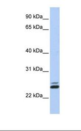 JAZF1 Antibody - Jurkat cell lysate. Antibody concentration: 1.0 ug/ml. Gel concentration: 12%.  This image was taken for the unconjugated form of this product. Other forms have not been tested.