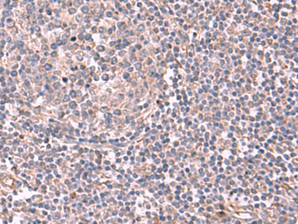 JAZF1 Antibody - Immunohistochemistry of paraffin-embedded Human tonsil tissue  using JAZF1 Polyclonal Antibody at dilution of 1:55(×200)