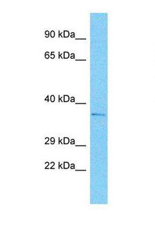 JCG1 / OR5P3 Antibody - Western blot of Human MCF7. OR5P3 antibody dilution 1.0 ug/ml.  This image was taken for the unconjugated form of this product. Other forms have not been tested.