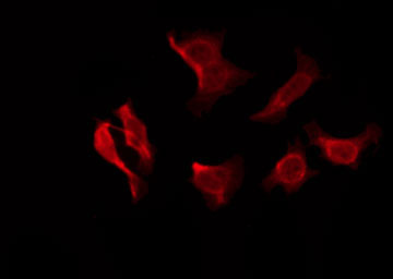 JCG1 / OR5P3 Antibody - Staining COLO205 cells by IF/ICC. The samples were fixed with PFA and permeabilized in 0.1% Triton X-100, then blocked in 10% serum for 45 min at 25°C. The primary antibody was diluted at 1:200 and incubated with the sample for 1 hour at 37°C. An Alexa Fluor 594 conjugated goat anti-rabbit IgG (H+L) Ab, diluted at 1/600, was used as the secondary antibody.