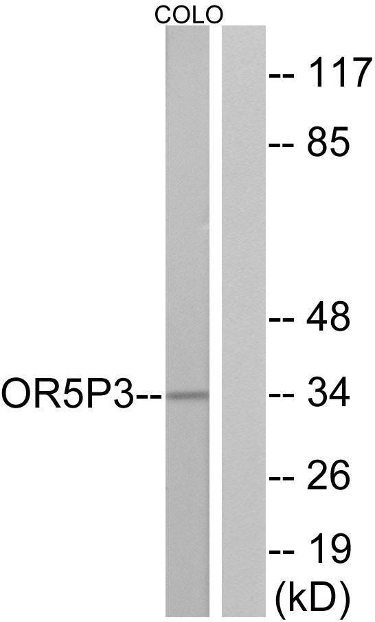 JCG1 / OR5P3 Antibody - Western blot analysis of extracts from COLO cells, using OR5P3 antibody.