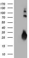JCHAIN / Ig J Chain Antibody - HEK293T cells were transfected with the pCMV6-ENTRY control (Left lane) or pCMV6-ENTRY IGJ (Right lane) cDNA for 48 hrs and lysed. Equivalent amounts of cell lysates (5 ug per lane) were separated by SDS-PAGE and immunoblotted with anti-IGJ.