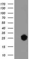 JCHAIN / Ig J Chain Antibody - HEK293T cells were transfected with the pCMV6-ENTRY control (Left lane) or pCMV6-ENTRY IGJ (Right lane) cDNA for 48 hrs and lysed. Equivalent amounts of cell lysates (5 ug per lane) were separated by SDS-PAGE and immunoblotted with anti-IGJ.