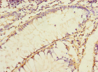 JCHAIN / Ig J Chain Antibody - Immunohistochemistry of paraffin-embedded human colon cancer at dilution 1:100