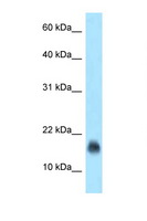 JCHAIN / Ig J Chain Antibody - IGJ antibody Western blot of Jurkat Cell lysate. Antibody concentration 1 ug/ml.  This image was taken for the unconjugated form of this product. Other forms have not been tested.