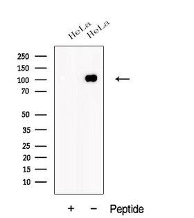 JEAP / AMOTL1 Antibody - Western blot analysis of extracts of HeLa cells using AMOTL1 antibody. The lane on the left was treated with blocking peptide.